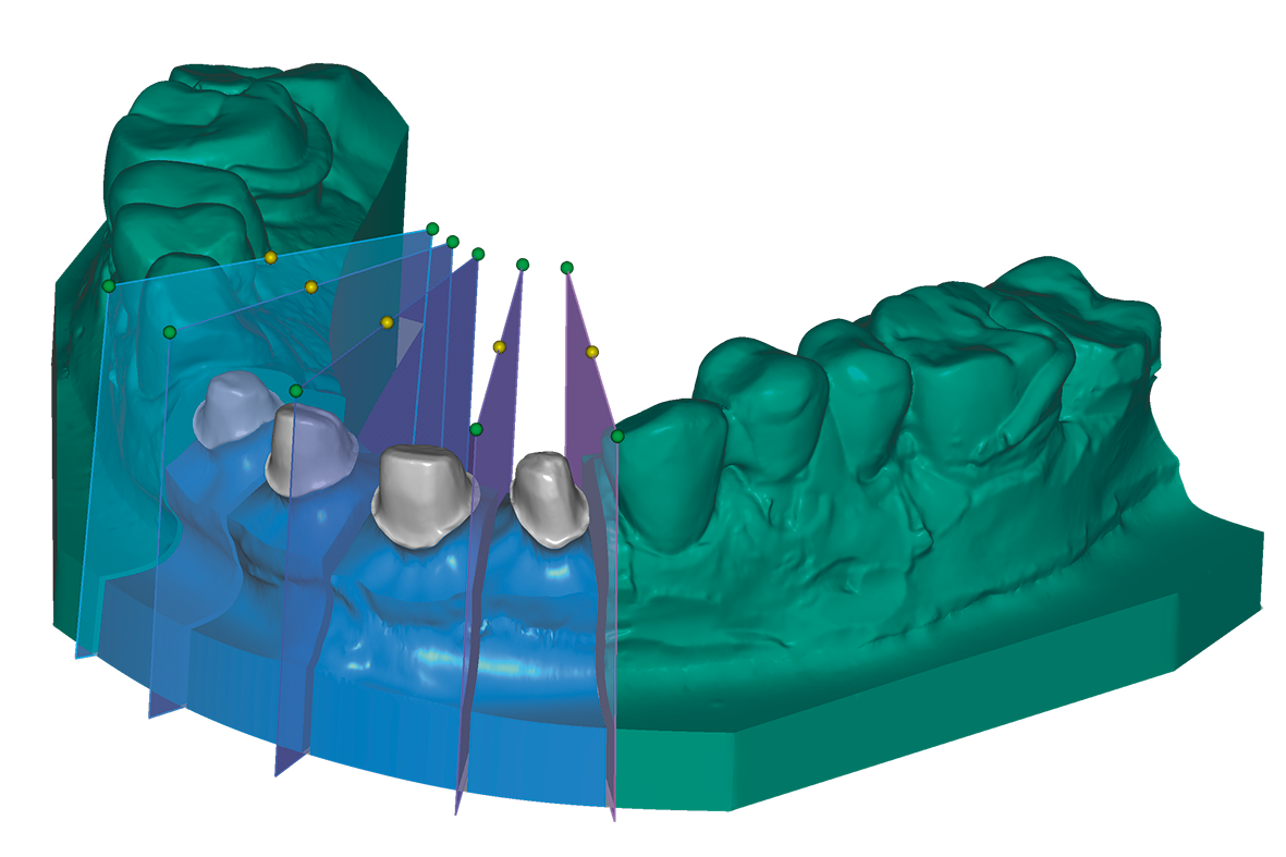 dental CAD 2