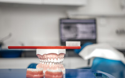 6 Benefits of 3D-Printed Crowns and Bridges in Dentistry