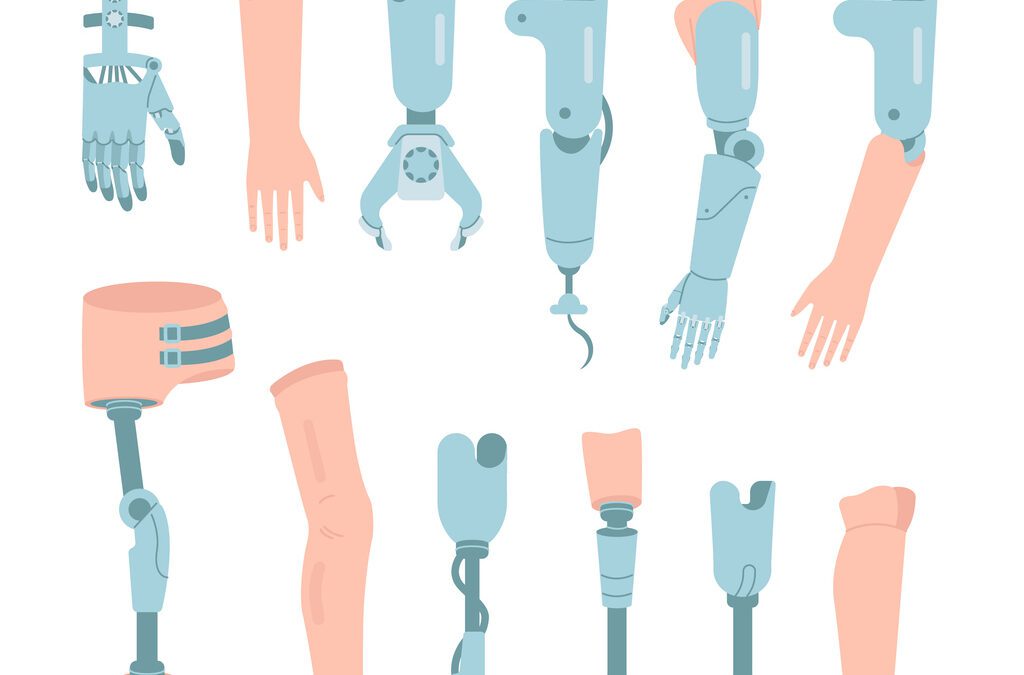 Enhancing Quality of Life With 3D Printed Limb Solutions