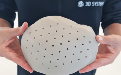 Nota3D Announces FDA Approval for the PEEK Cranial Implant